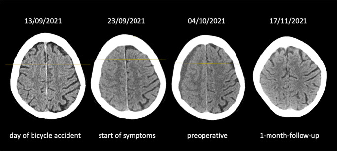 Fig. 1