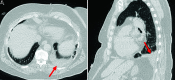 FIG 3.