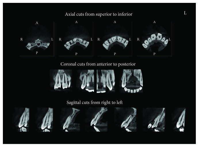 Figure 25