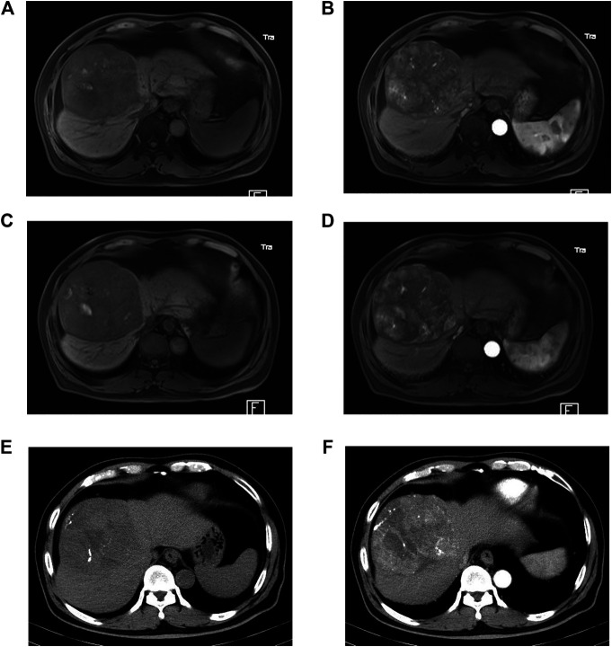 FIGURE 2