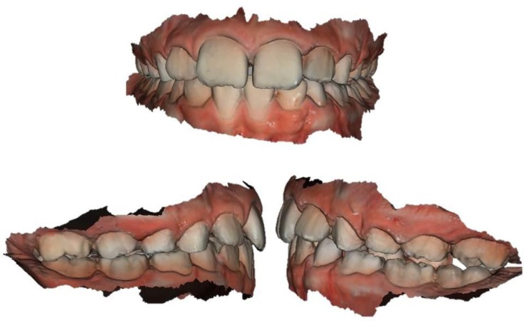 Fig. (2)