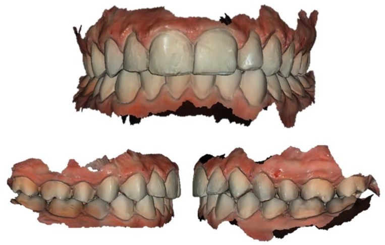 Fig. (1)