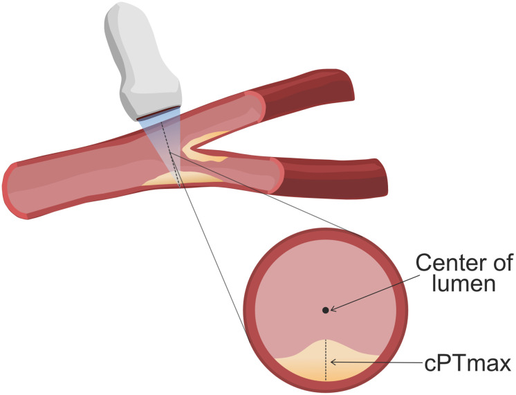 Fig 1