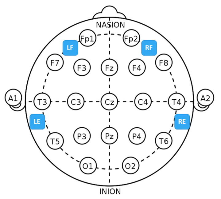 Supplementary figure 1