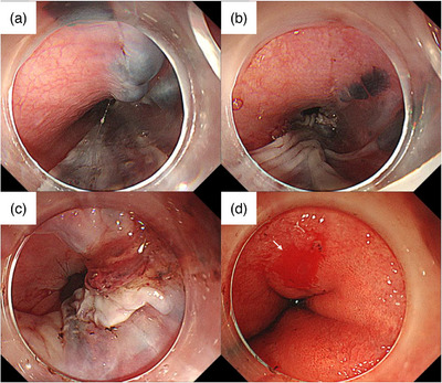 FIGURE 3