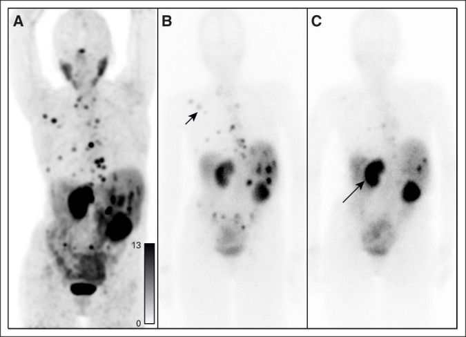 FIG 2.