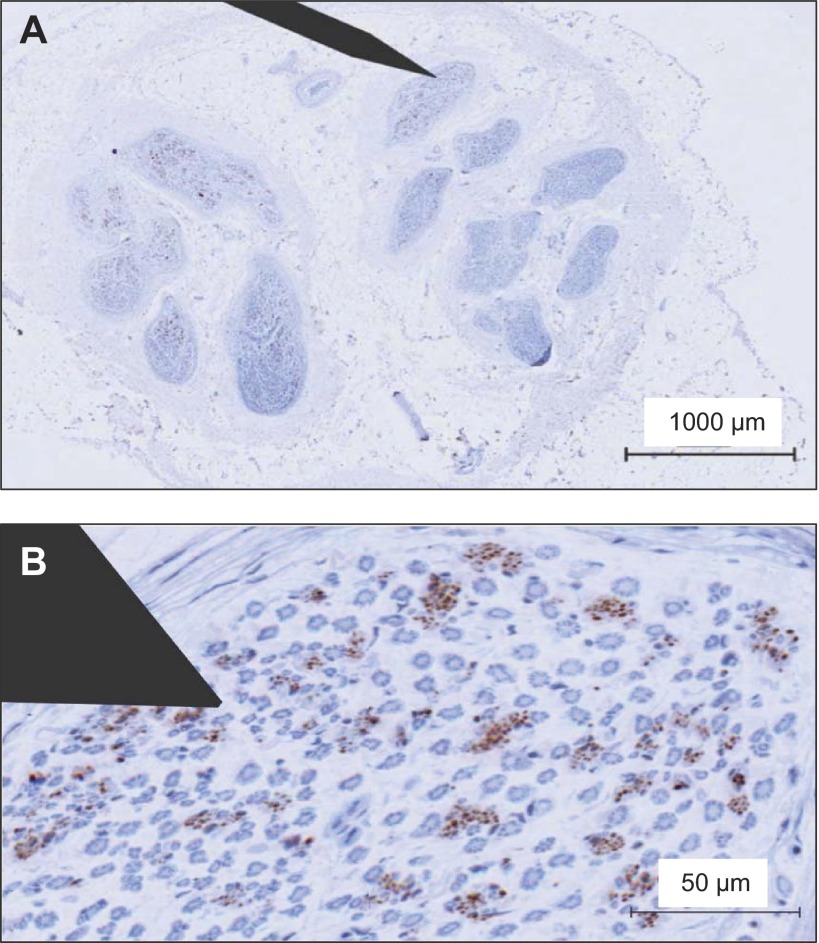 Fig. 10.