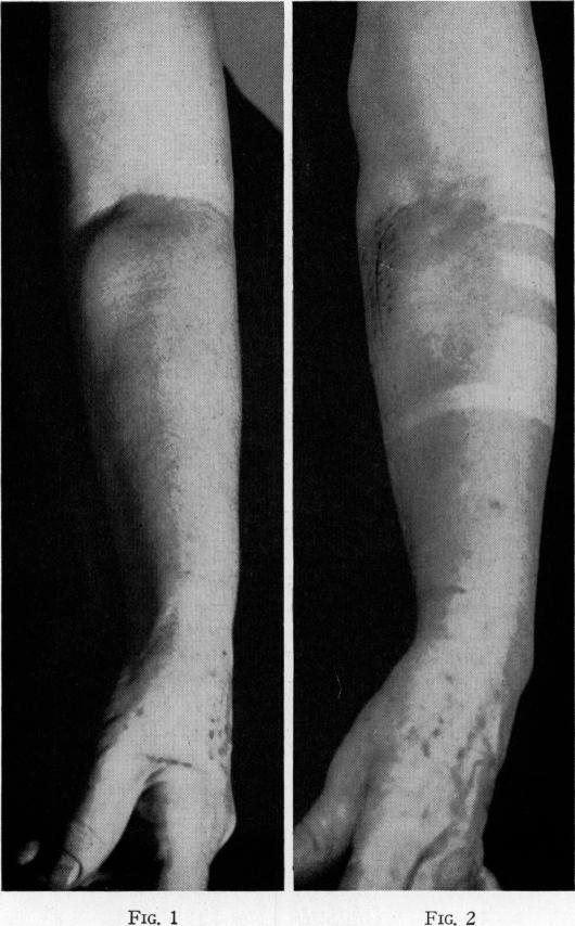 Fig. 1., Fig. 2.