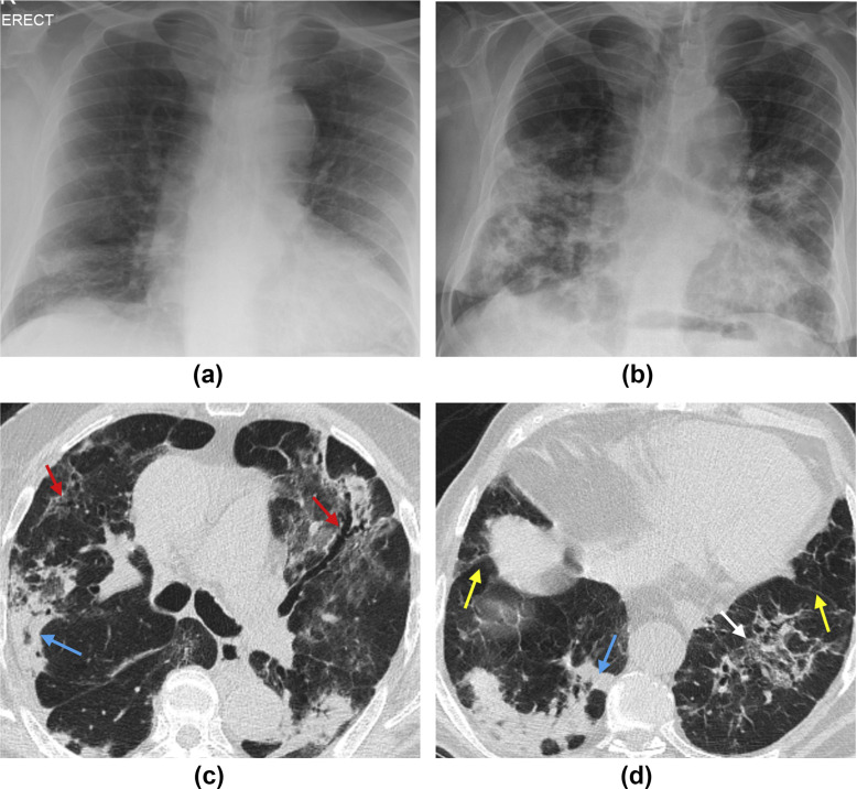 Figure 4