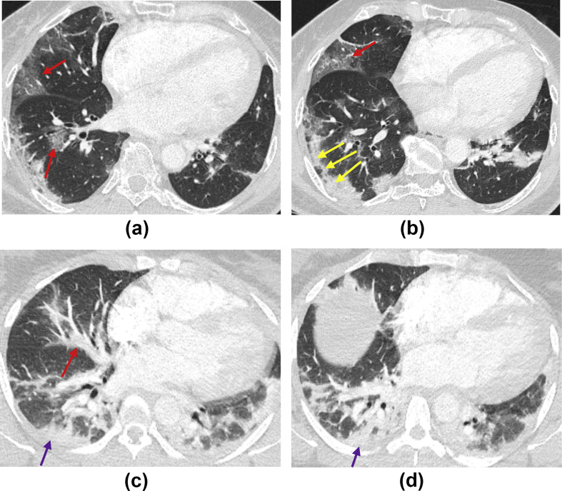 Figure 3