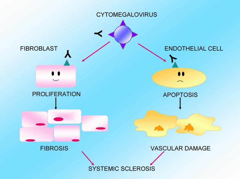 Cytomegalovirus in the pathogenesis of systemic sclerosis