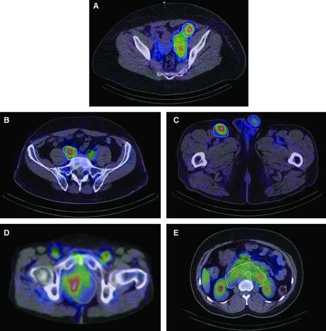 FIG. 1.