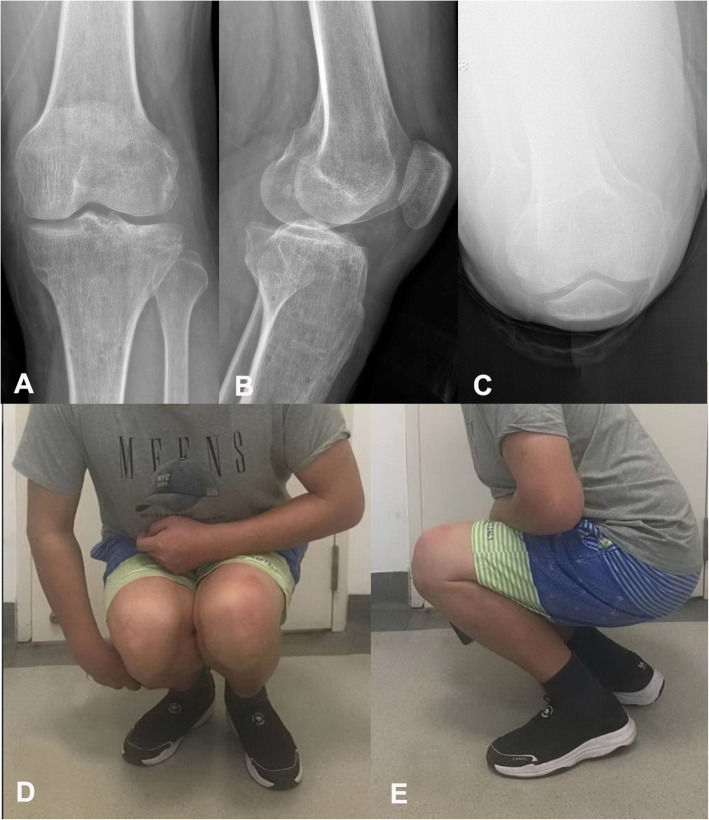 Fig. 6