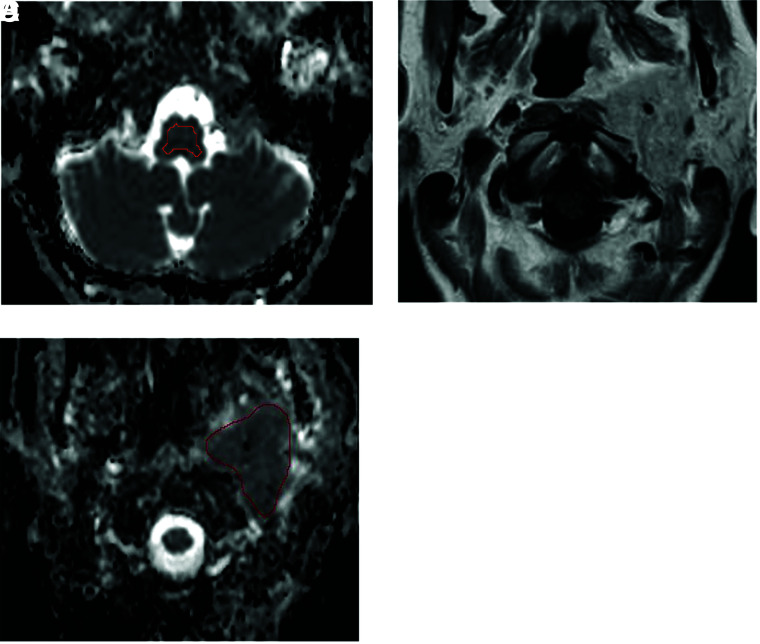 FIG 1.