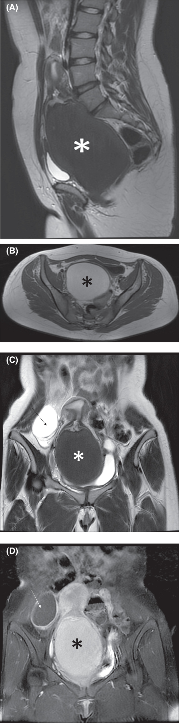 FIGURE 1