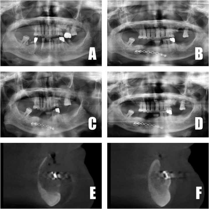 Fig. 4