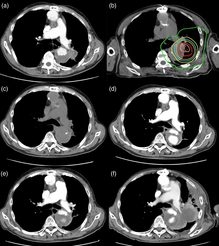 Fig. 2.