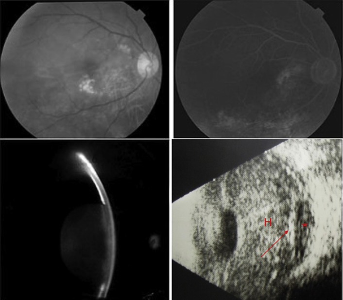 Fig. 1