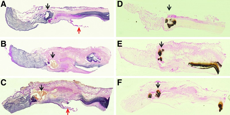 FIG. 5.