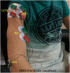 Fig 4