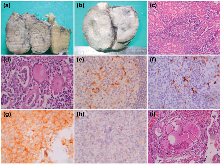 Morphological and immunohistochemical approaches to the diagnosis of ...