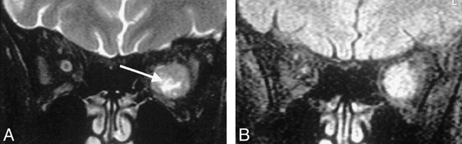 fig 5.