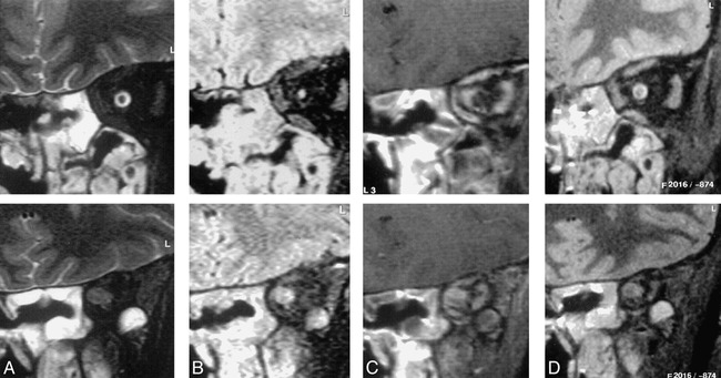 fig 2.