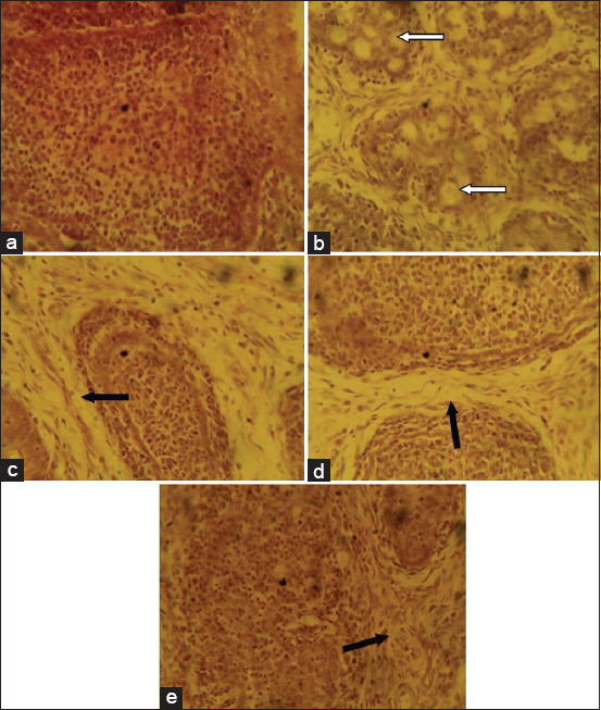 Figure-4