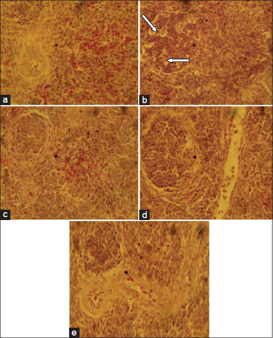 Figure-3