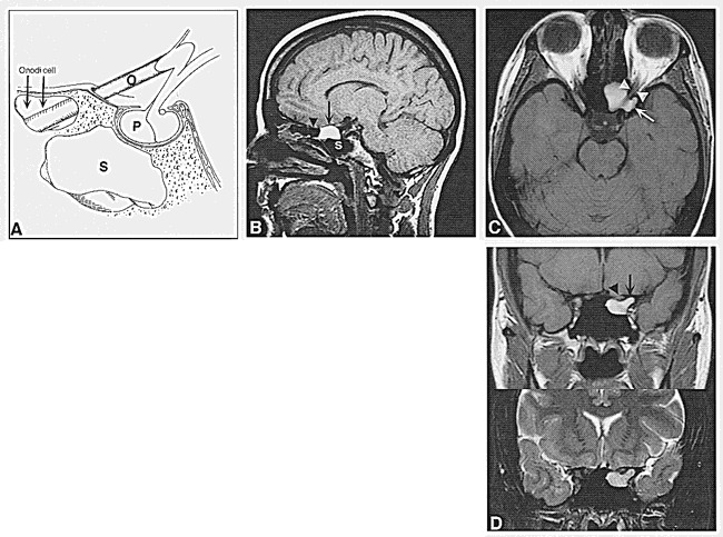 fig 1.