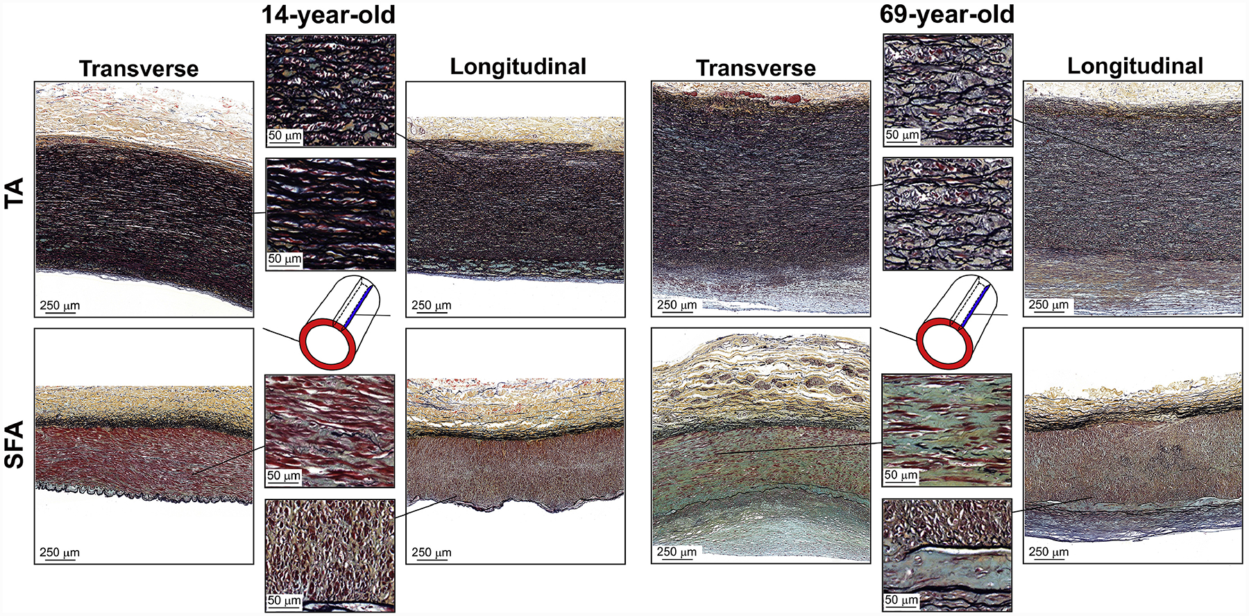 Figure 11: