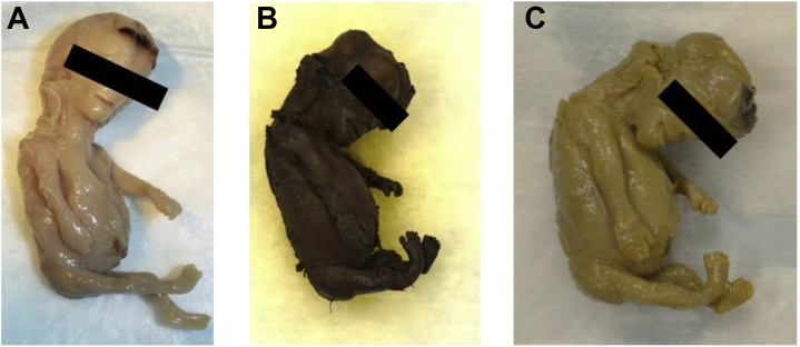 Supplemental Figure 1