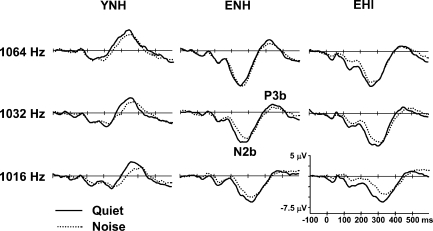 Fig. 11