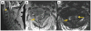 FIG. 7