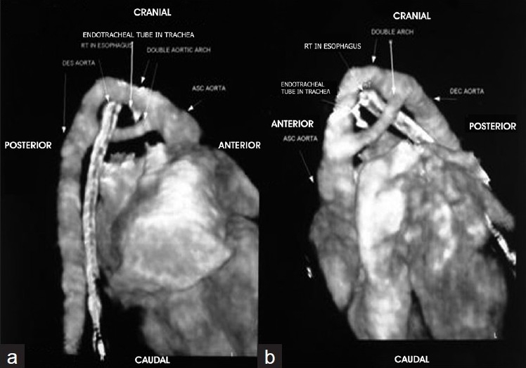 Figure 1 (a,b)