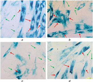 Fig. 19