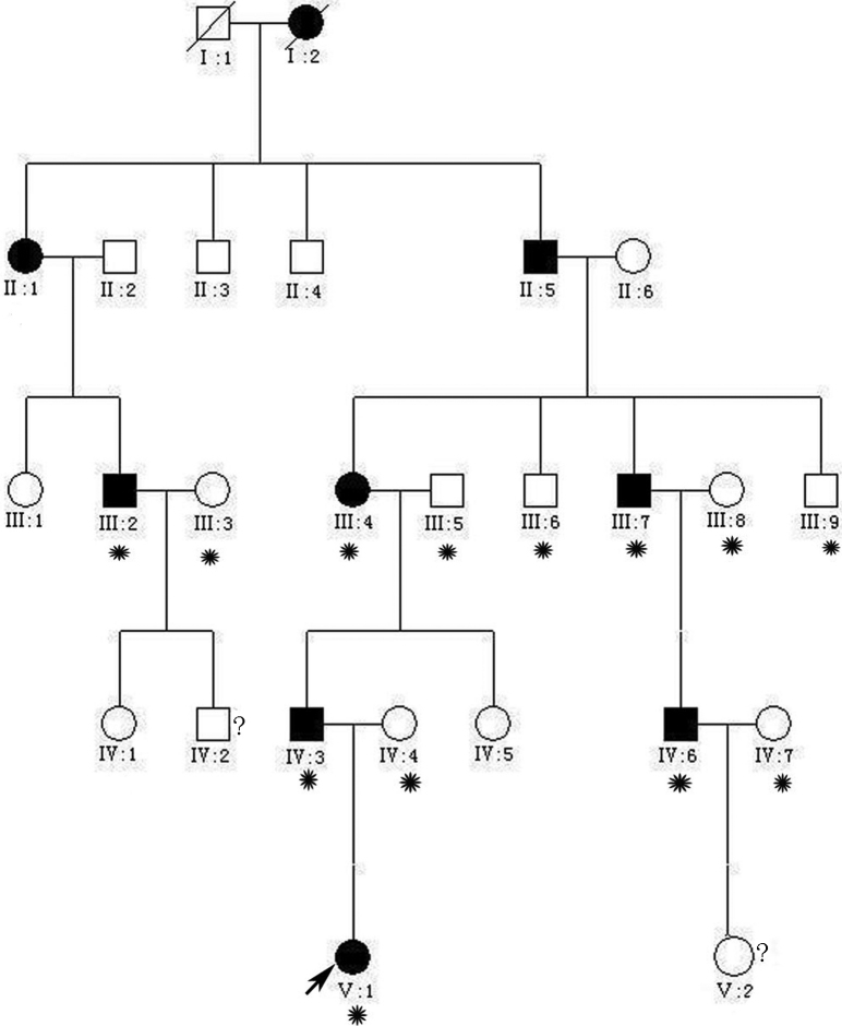 A G→T splice site mutation of CRYBA1/A3 associated with autosomal ...