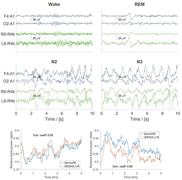 FIGURE 4