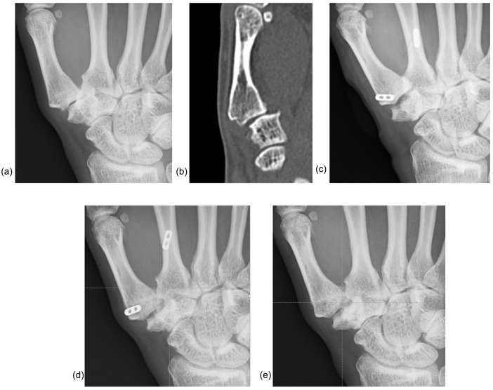 Figure 4.