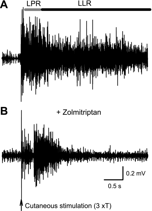 Fig. 11.