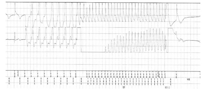 Fig. 4.