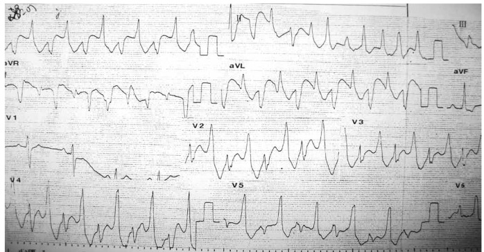 Fig. 1.