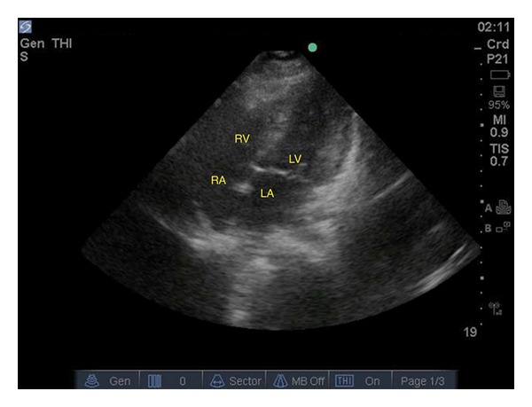 Figure 2