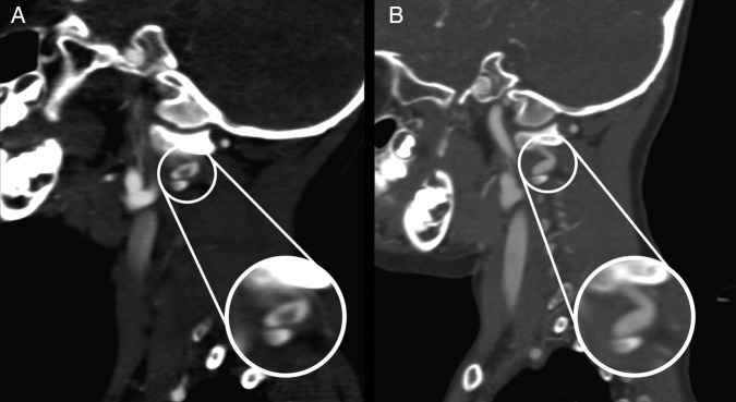 Figure 3