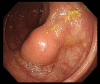 Figure 2: