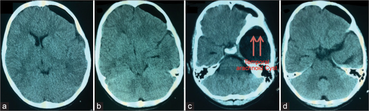 Figure 3: