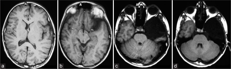 Figure 4: