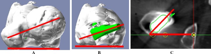 Fig. 2