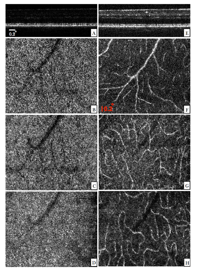 Fig. 4