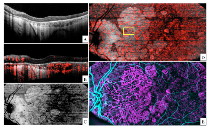 Fig. 9